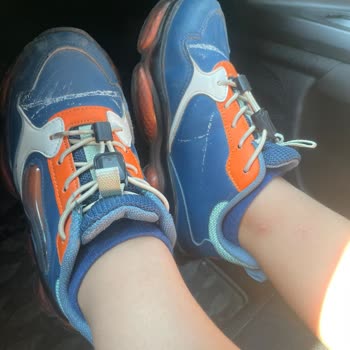 Aldığım Ayakkabıda Sürekli Oluşan Kimyasal Lekeler Mağduriyet Yaratıyor