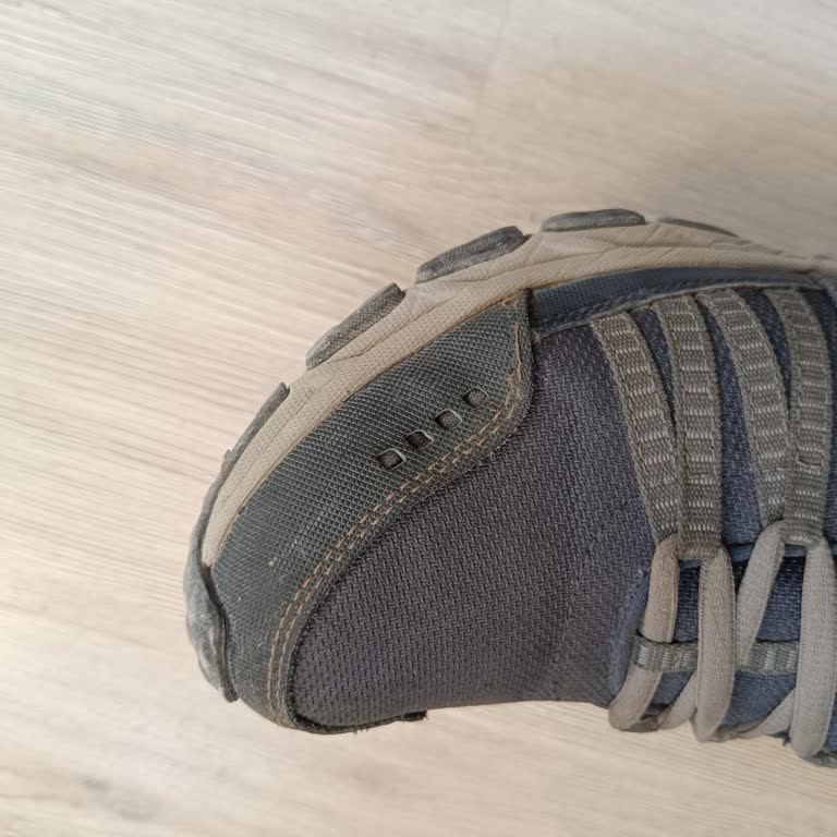 Skechers Ayakkabıda Kısa Sürede Patlama Ve Hayal Kırıklığı