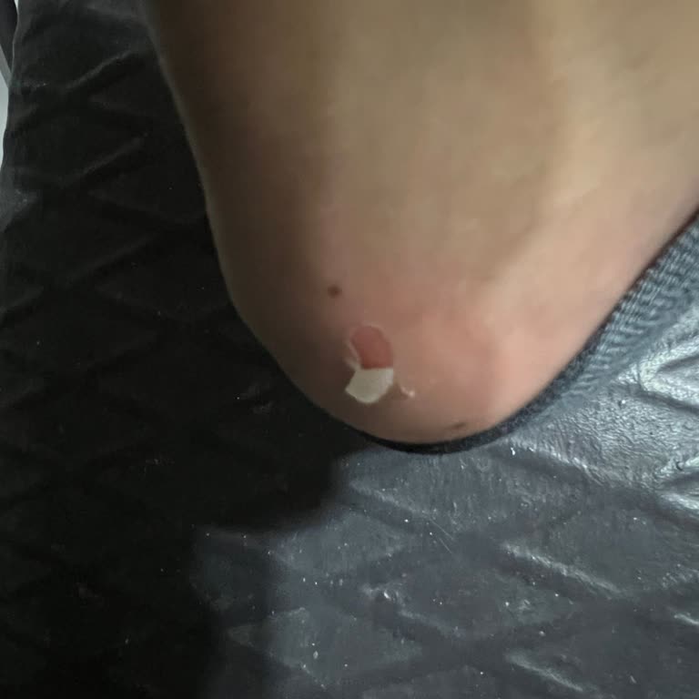 Puma Ayakkabıda Tekrarlayan Taban Sorunu Ve İade Talebi