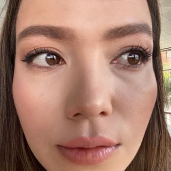 Loreal Paris Maskara Kullanımı Sonrası Ciddi Alerjik Reaksiyon Yaşadım