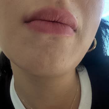 Aldığım Fondöten Cildimde Olumsuz Sonuç Verdi, İade Ve Çözüm Talep Ediyorum