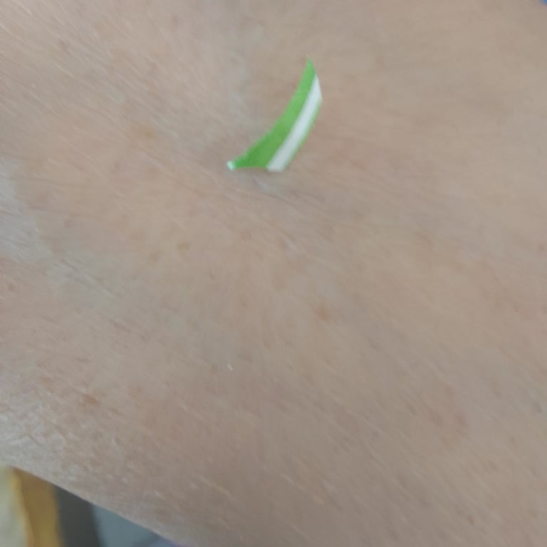 Cips Paketinden Plastik Parça Çıktı, Sağlığım Tehlikeye Girdi