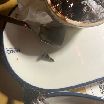 Sufleden Vida Çıkmasıyla Yaşanan Hijyen Skandalı