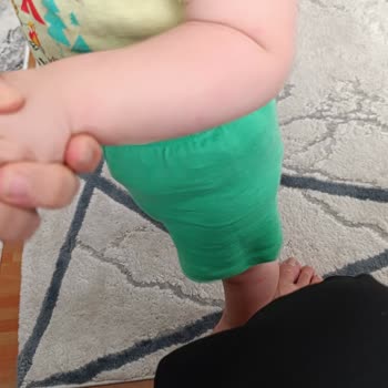 Bebelac 4 Formula Triggered Severe Allergy and Rashes in My 13-Month-Old Baby