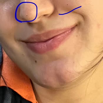 İos 26 Güncellemesi Sonrası Ön Kamera Fotoğraflarında Siyah Nokta Sorunu