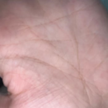 İos 26 Güncellemesi Sonrası Ön Kamera Fotoğraflarında Siyah Nokta Sorunu