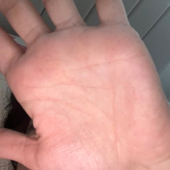 İos 26 Güncellemesi Sonrası Ön Kamera Fotoğraflarında Siyah Nokta Sorunu