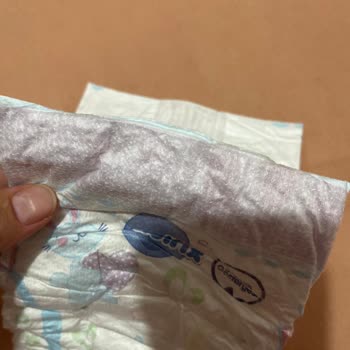 Molfix Bebek Bezinde Sızıntı Ve Pişik Sorunu, Üretim Hatası Şüphesi