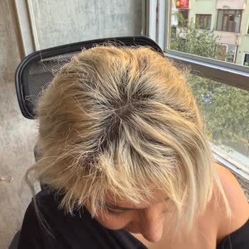 Diyarbakır Lotus Bayan Kuaförü Saçlarımı Yaktı!