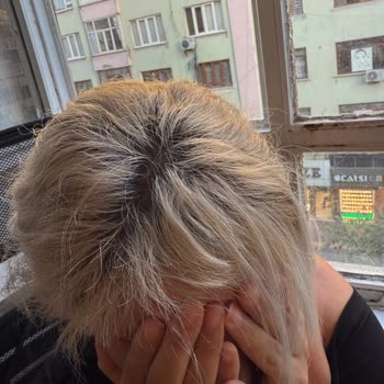 Diyarbakır Lotus Bayan Kuaförü Saçlarımı Yaktı!