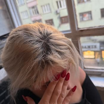 Diyarbakır Lotus Bayan Kuaförü Saçlarımı Yaktı!