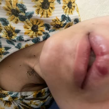 Güzellik Salonunda Sonuçsuz İşlemler Ve İade Mağduriyeti