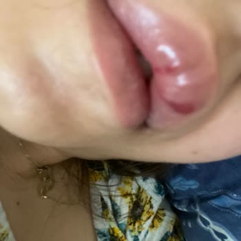 Güzellik Salonunda Sonuçsuz İşlemler Ve İade Mağduriyeti