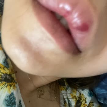 Güzellik Salonunda Sonuçsuz İşlemler Ve İade Mağduriyeti