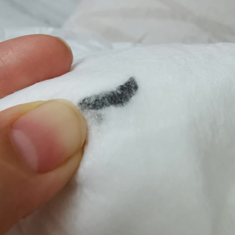 Bebek Bezlerinde Mürekkep Lekesi Ve İlgisiz Müşteri Hizmeti