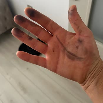 Bosch Ankastre Set: Temizlik Sorunu Ve Fatura Mağduriyeti