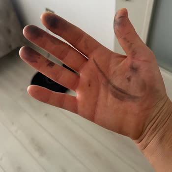 Bosch Ankastre Set: Temizlik Sorunu Ve Fatura Mağduriyeti