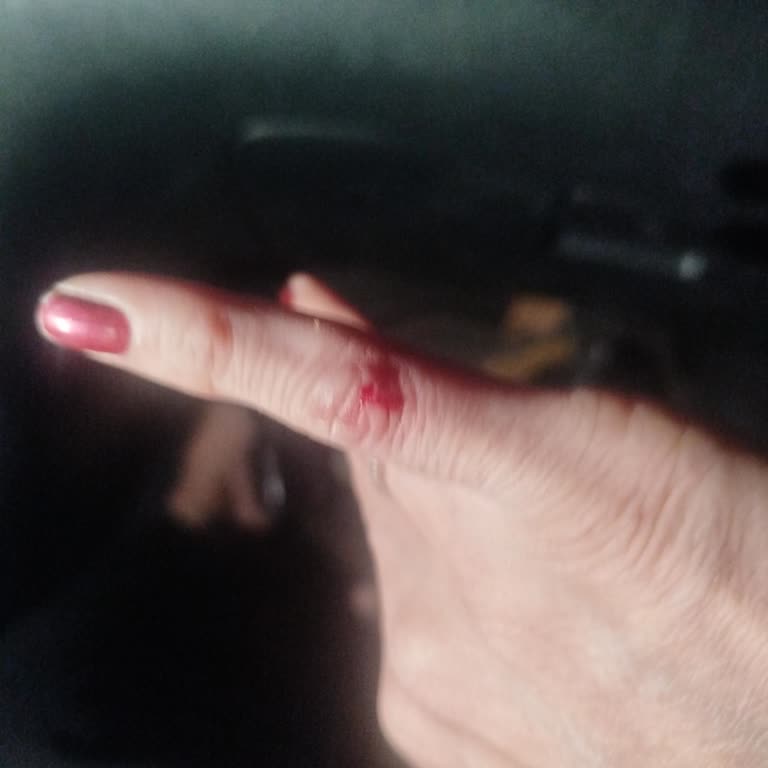 Bakımsız Tuvalet Ve Güvenlik Önlemi Eksikliği Mağduriyeti