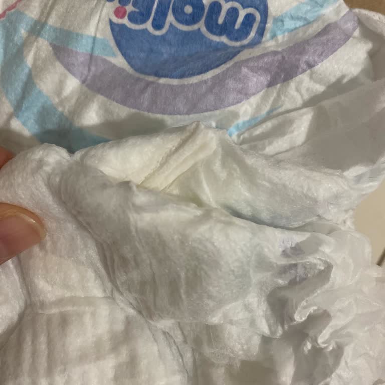 Molfix Bebek Bezinden Çıkan Sert Plastik Parça Bebeğimi Yaraladı