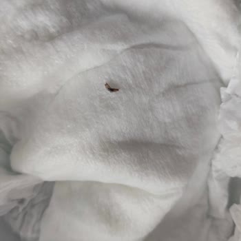 Bebek Bezinden Canlı Böcek Çıktı, Güvenimiz Sarsıldı