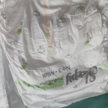 Bebek Bezinden Canlı Böcek Çıktı, Güvenimiz Sarsıldı