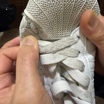 Adidas Kısa Sürede Açılan Ayakkabımın Değişimi Reddedildi