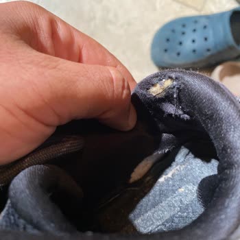 Skechers Ayakkabım 6 Ayda Yırtıldı Garanti Ve Müşteri Hizmetleri Mağdur Etti