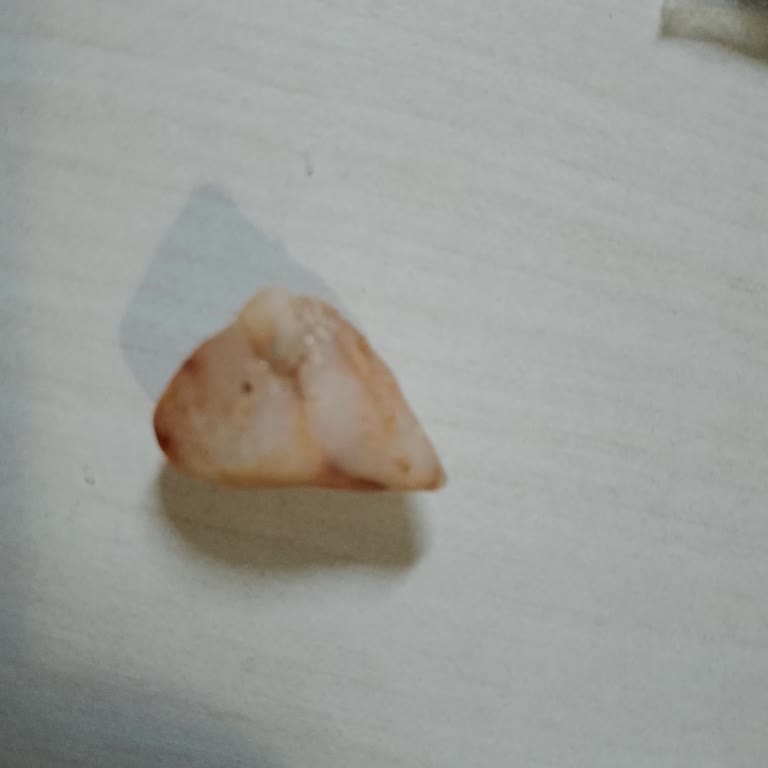 Aldığım Antep Fıstığı Paketinden Taş Çıkması Ve Kalite Kontrol Eksikliği