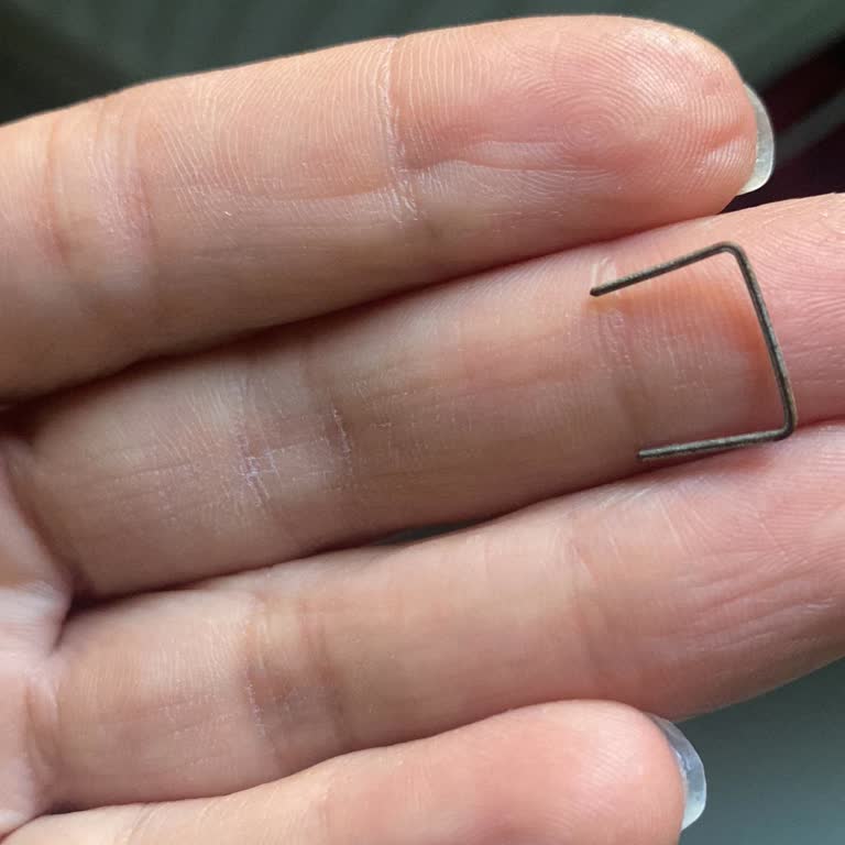 Kahve Ürününde Yabancı Madde Bulunması Hakkında Şikayet