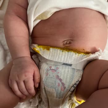 Molfix Bebek Bezinde Sürekli Sızıntı Sorunu Ve Mağduriyet