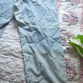 Hiç Kullanılmayan Pantolonda Renk Bozulması Ve İade Sorunu