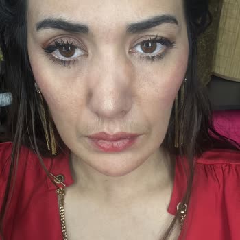 Doç. Dr. İhsan Kuzucu Hatasını Kabul Etmeyip Hastam Değil Diye Reddediyor