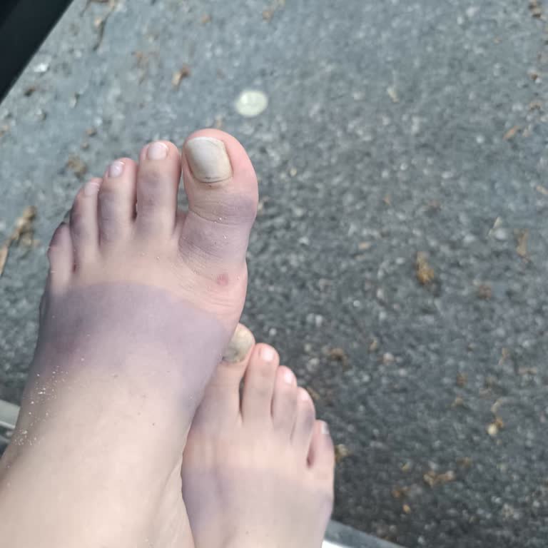 Kusurlu Terlik İçin İade Talebim Reddedildi, Çözüm Sunulmadı