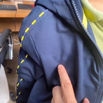 Fenerium'dan Aldığım Üründe Renk Solması ve İade Sorunu