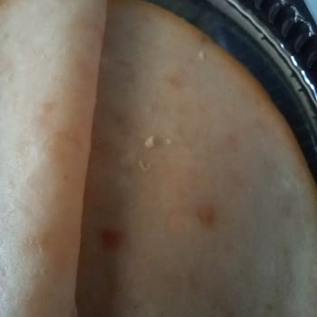 Aldığım Hindi Füme Ürününde Yabancı Cisimle Karşılaştım, Sağlık Endişesi Yaşıyorum