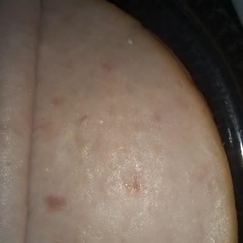 Aldığım Hindi Füme Ürününde Yabancı Cisimle Karşılaştım, Sağlık Endişesi Yaşıyorum