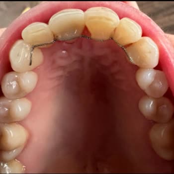 Klinik 45’te Yapılan Hatalı Diş Tedavisi Sonucu Yaşadığım Sağlık Sorunları Ve İlgisizlik