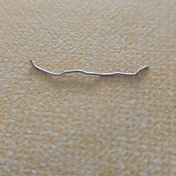 Klinik 45’te Yapılan Hatalı Diş Tedavisi Sonucu Yaşadığım Sağlık Sorunları Ve İlgisizlik