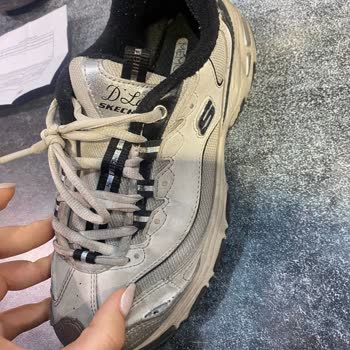 Kısa Sürede Deforme Olan Skechers Ayakkabıya İlgisiz Müşteri Hizmetleri