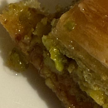 Baklavadan Çıkan Kıllar Ve Çözüm Sunulmayan Hijyen Sorunu