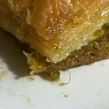 Baklavadan Çıkan Kıllar Ve Çözüm Sunulmayan Hijyen Sorunu