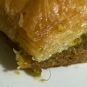 Baklavadan Çıkan Kıllar Ve Çözüm Sunulmayan Hijyen Sorunu