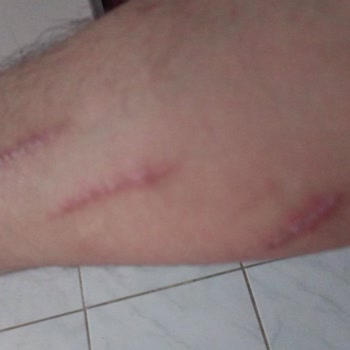 Maaşımı Kendi Paramı Çekemiyorum: Haksız Limit Ve Kesinti Mağduriyeti