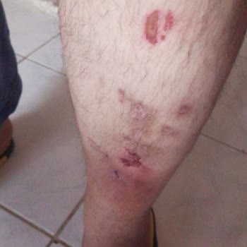 Maaşımı Kendi Paramı Çekemiyorum: Haksız Limit Ve Kesinti Mağduriyeti