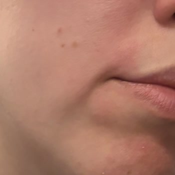 Yves Rocher Maske Peeling Cildimde Tahrişe Ve Kızarıklığa Yol Açtı İade Edilmedi