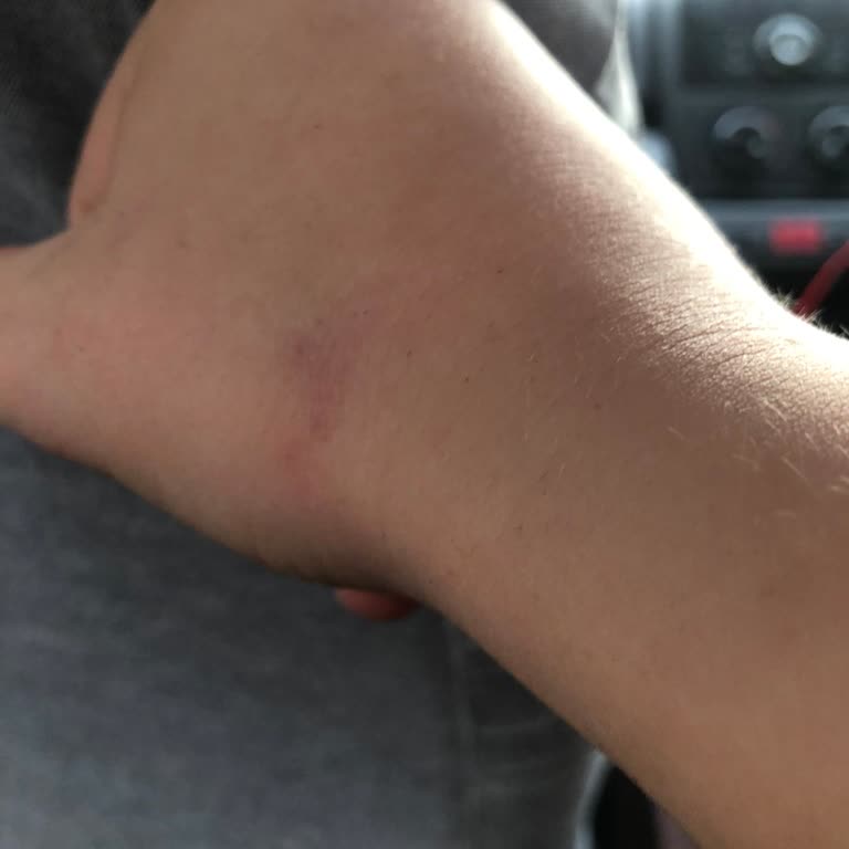 Milli Eğitim Bakanlığı Okulda Öğretmenden Fiziksel Ve Sözlü Şiddet