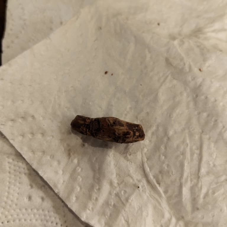 Torku Antep Fıstıklı Çikolatadan Yabancı Madde Çıkması Nedeniyle Sağlık Endişesi