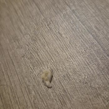 Siparişimde Hijyen Sorunu Ve İade Reddi