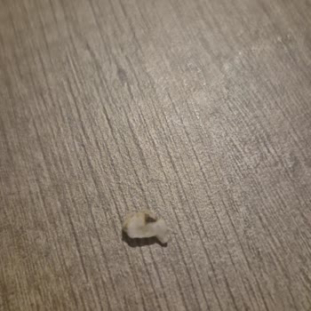 Siparişimde Hijyen Sorunu Ve İade Reddi