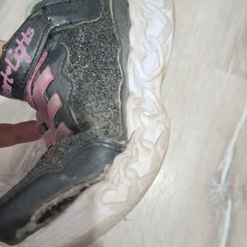 Kısa Sürede Hasar Gören Skechers Ayakkabıya Çözüm Bulunmadı